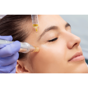 PRP for undereye treatment