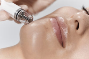 Diamondglow wand device working on woman's skin
