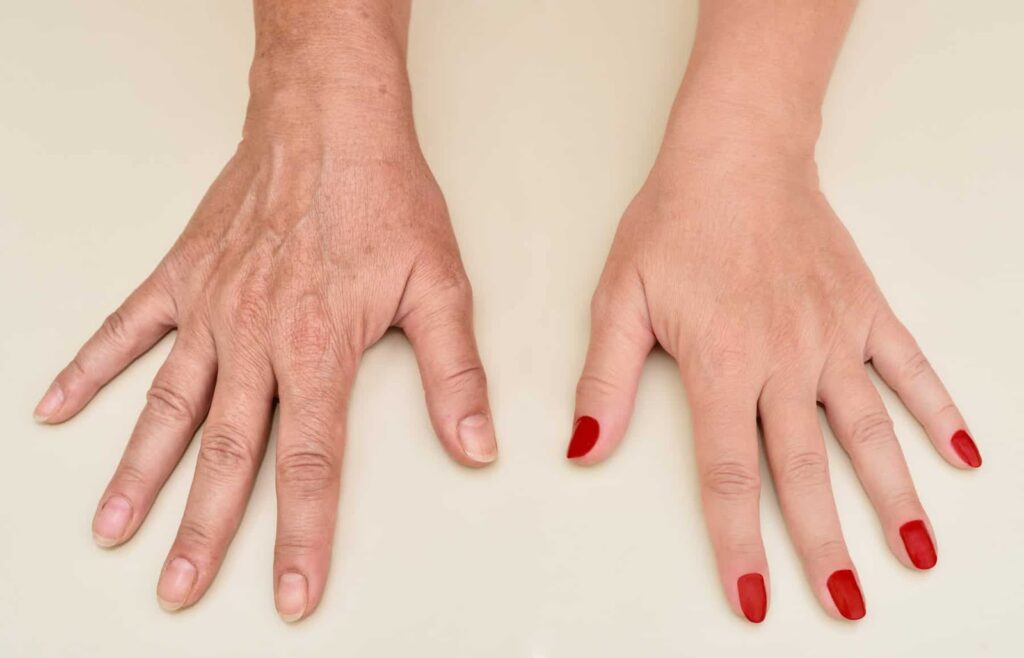 caring for aging hands - colair beauty lounge (2)
