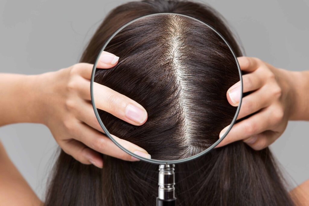 Scalp Health 101 The Foundation of Beautiful Hair