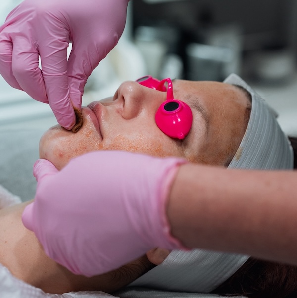 Complimentary Skinbetter Peel with a DiamondGlow Facial ($125 value!)