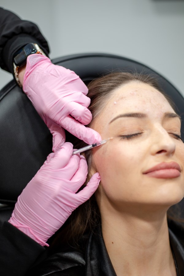 crows feet botox (2)