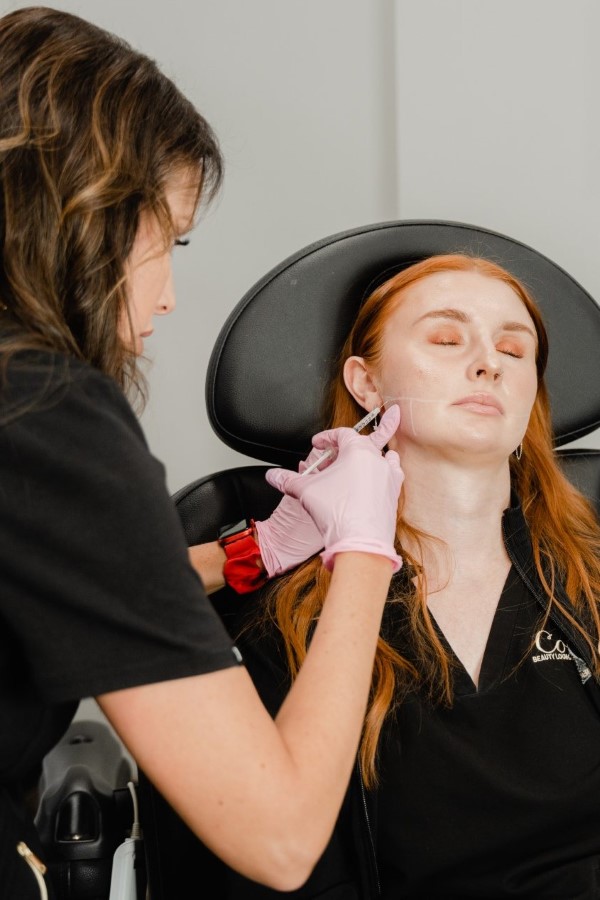 lower face botox (2)