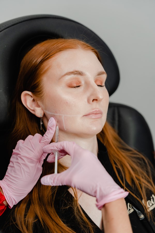 lower face botox (3)