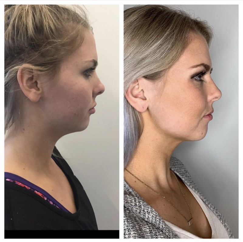 Photo 2020-11-28, 2 22 42 PM