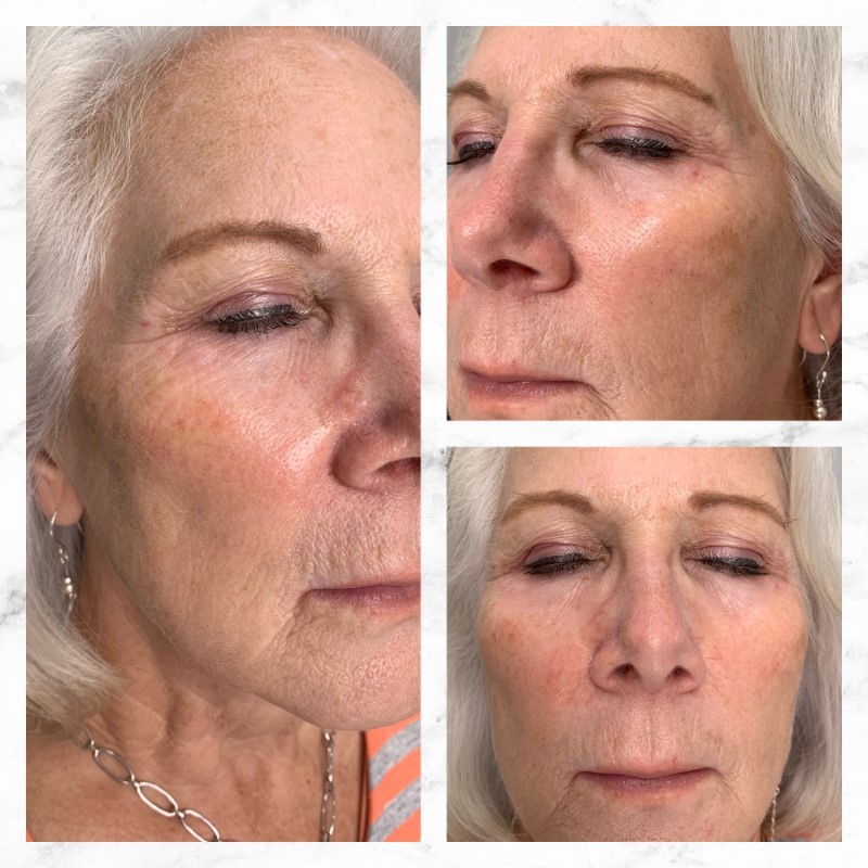 Photo Jun 10, 3 01 23 PM