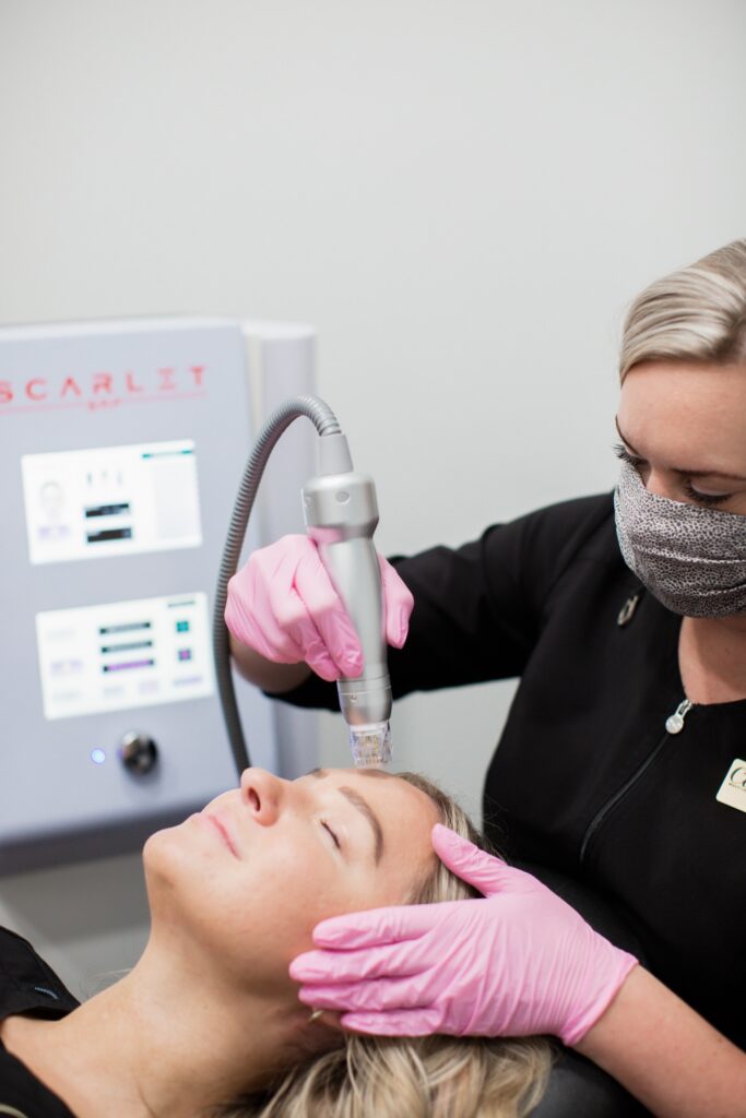 Scarlet Microneedling