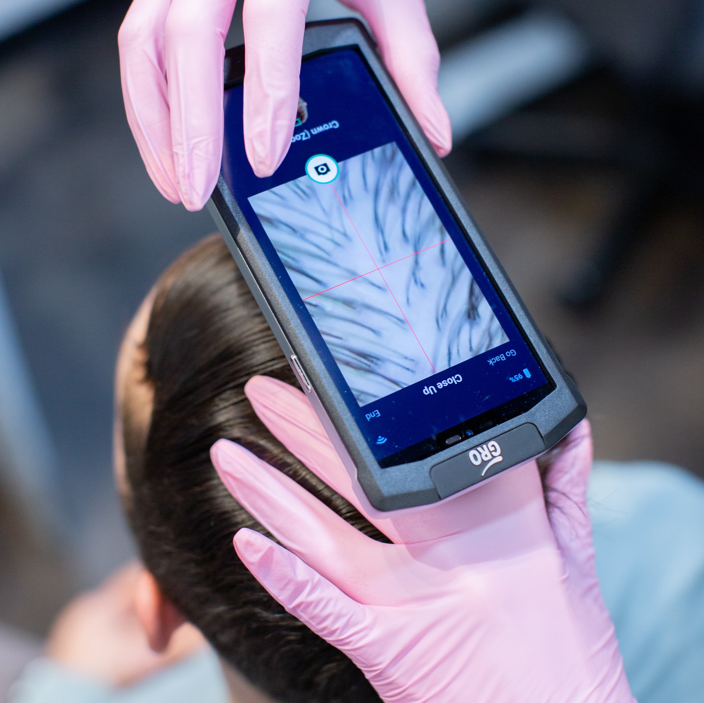 FREE Scalp & Hair Analysis ($199 Value)