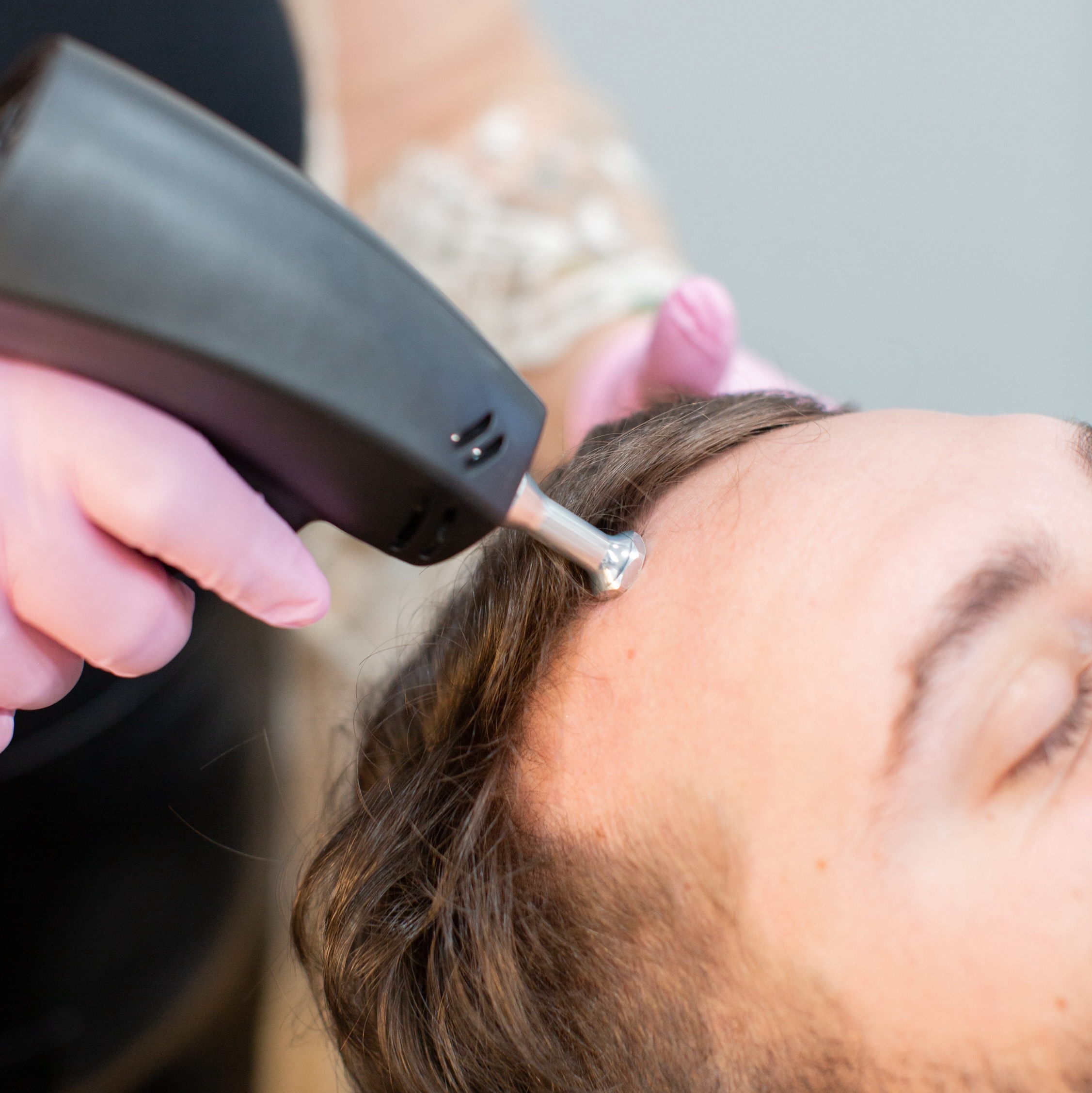 $150 OFF TED Hair Restoration Package of 3 Treatments