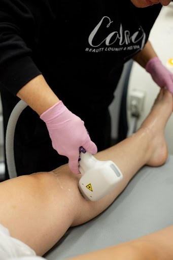 Laser Hair Removal