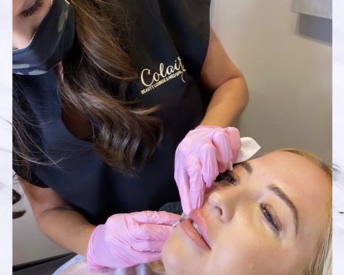 Colair Med Spa lip filler treatment