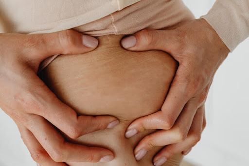 Person holding onto body stretch marks